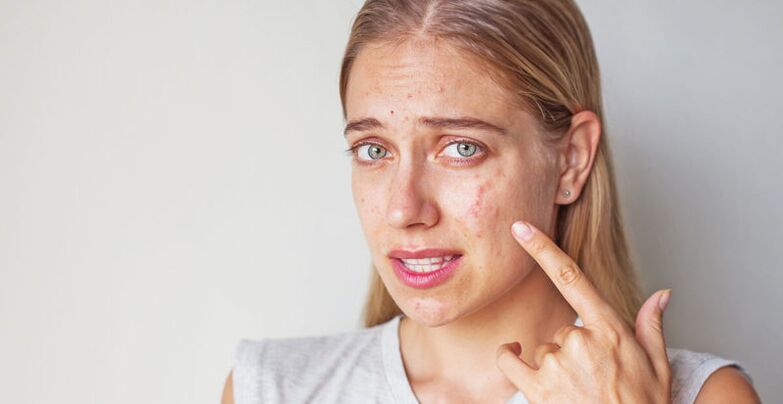 skin problems when you stop smoking