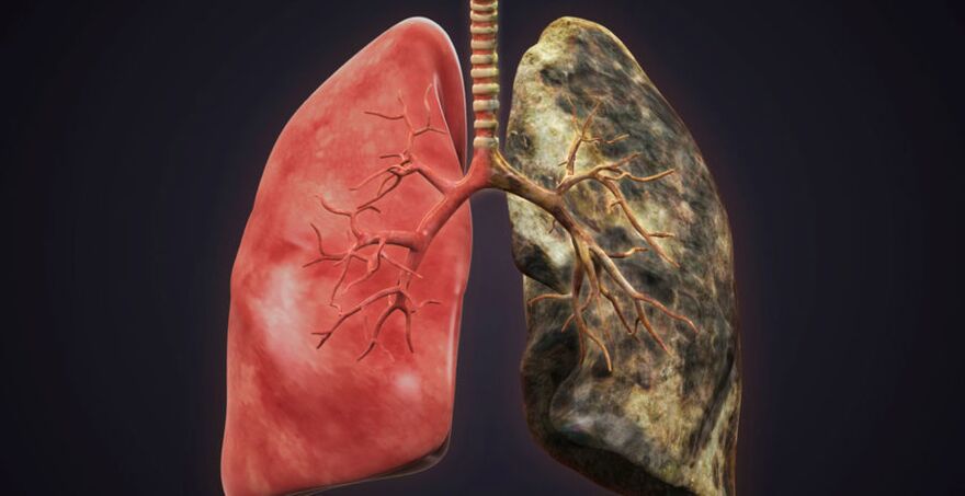 smoker's lung and lung to quit smoking